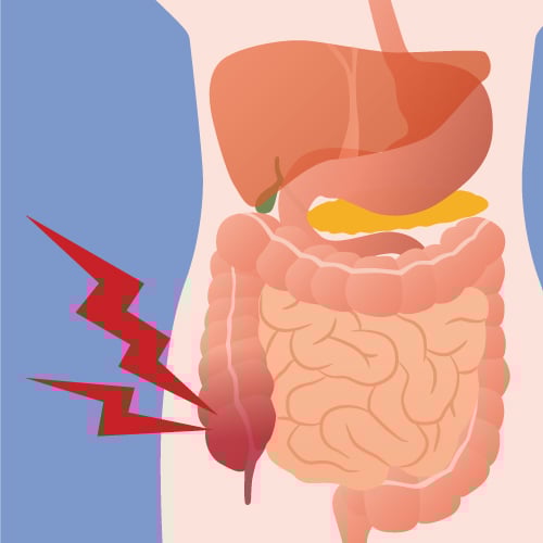 appendix-art.jpg appendix-art.jpg